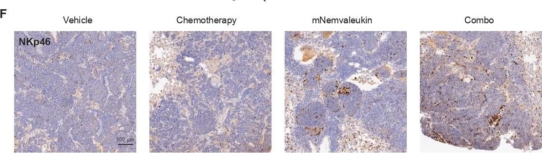 mNemvaleukin alone and combination treatments expand tumor-infiltrating NK cells in SCLC. (A) Schematic showing experimental design for immune profiling. After confirming tumor burden by MRI, mice were randomized into vehicle, chemotherapy, mNemvaleukin, and combo (chemotherapy+mNemvaleukin) treatment groups. Tumor nodules were collected and tumor-infiltrating lymphocytes were analyzed by flow cytometry at day 7 after treatment initiation. (B) Representative plots of infiltrating NK cells (CD3−CD49b+) are shown on indicated treatment. (C, D) Frequencies of total infiltrating NK cells (C), activated NK cells (D) and expression of Ki-67+ (E) in NK cells are presented. Two independent cohorts were performed (n=4 in total for each group). (F) IHC staining of NKp46 on tumor samples treated with vehicle, chemotherapy, mNemvaleukin, and combo regimens. Data shown as means±SEM. *P<0.05, **P<0.01, ***P<0.001. IHC, Immunohistochemistry; mNemvaleukin, mouse version of nemvaleukin; NK, natural killer; ns, not significant (unpaired two-tailed t test); SCLC, small cell lung cancer. Image collected and cropped by CiteAb from the following open publication (//pubmed.ncbi.nlm.nih.gov/36472839), licensed under a CC-BY license. Not internally tested by R&D Systems.