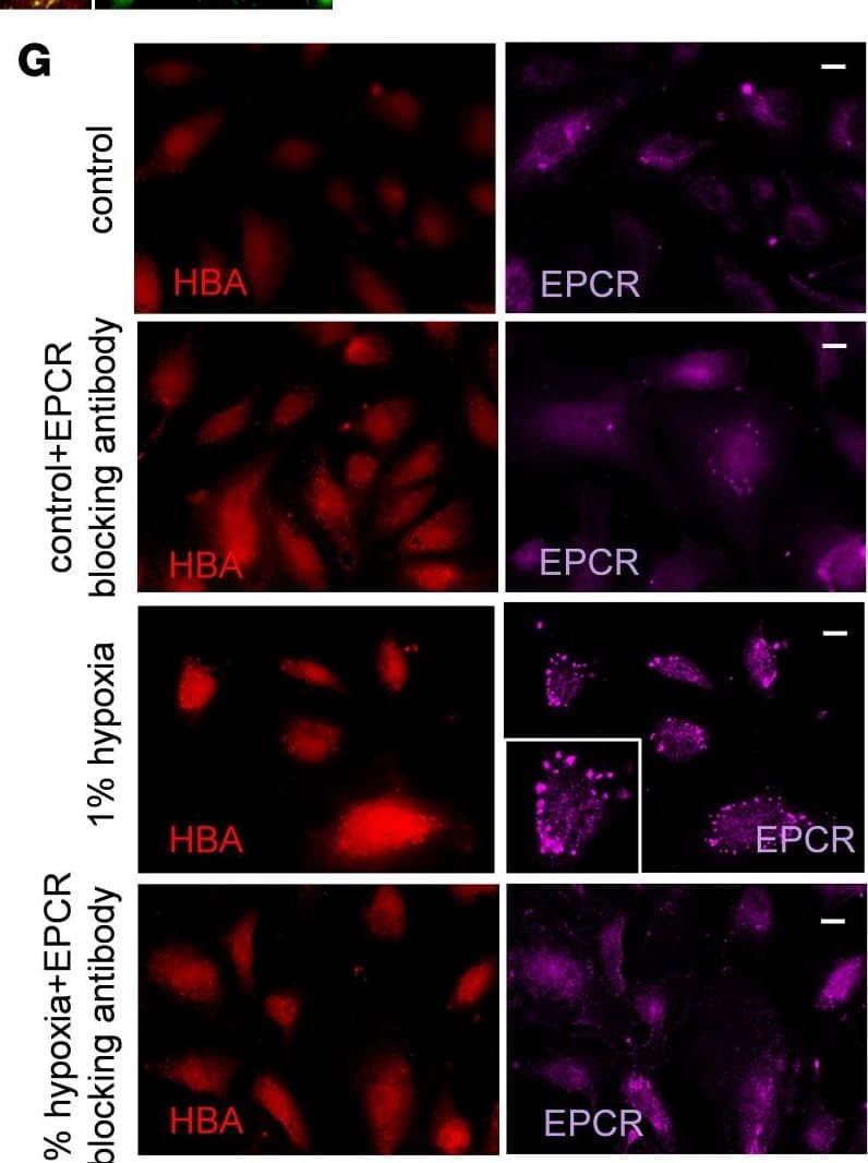 Effect of hypoxia on endothelial hemoglobin & EPCR expression.(A) Representative WB of human cardiac microvascular endothelial  cultured under hypoxia (1% oxygen) showing HIF1A, NRF2, EPCR, HBA, & ACTB as a protein loading control; n = 3 biological replicates. Values under each blot image indicate fold changes versus results in control  (as determined by normalization to the loading control run on same blot). (B & C) Representative immunofluorescent images & quantification of human microvascular endothelial  cultured under hypoxia at different time points, as indicated, & stained for HBA (red) & NRF2 (green). Small image in 24-hour NRF2 panel shows overlay image of the cell. *P < 0.05 & ****P < 0.0001 versus control calculated using 1-way ANOVA, Bonferroni’s multiple-comparison test. (D) Representative immunofluorescent high-resolution images showing human microvascular endothelial  cultured under hypoxia (1% oxygen) & stained for PAR1 (green) & EPCR (purple) at the left panel or for PAR1 (green), EPCR (purple), & lysosomal tracker (Lyso; red) at the right panel; n = 3 biological replicates. Scale bars: 10 μm. (E & F) WB & quantification analysis of human microvascular endothelial  cultured under hypoxia (1% oxygen) showing NRF2, caveolin-1, &  beta -actin (ACTB) as a loading control; n = 3 biological replicates. ***P < 0.001 & ****P < 0.0001; 1-way ANOVA, Bonferroni’s multiple-comparison test. (G & H) Representative immunofluorescent images & quantification analysis showing human microvascular endothelial  cultured under hypoxia (1% oxygen), treated with EPCR-blocking antibody (20 μg/mL), as indicated, & stained for HBA (red) & EPCR (purple). Scale bars: 10 μm. **P < 0.01, ***P < 0.001, & ****P < 0.0001 versus control ; 1-way ANOVA, Bonferroni’s multiple-comparison test. Image collected & cropped by CiteAb from the following open publication (//pubmed.ncbi.nlm.nih.gov/35700057), licensed under a CC-BY license. Not internally tested by R&D Systems.