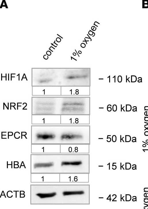 Effect of hypoxia on endothelial hemoglobin & EPCR expression.(A) Representative WB of human cardiac microvascular endothelial  cultured under hypoxia (1% oxygen) showing HIF1A, NRF2, EPCR, HBA, & ACTB as a protein loading control; n = 3 biological replicates. Values under each blot image indicate fold changes versus results in control  (as determined by normalization to the loading control run on same blot). (B & C) Representative immunofluorescent images & quantification of human microvascular endothelial  cultured under hypoxia at different time points, as indicated, & stained for HBA (red) & NRF2 (green). Small image in 24-hour NRF2 panel shows overlay image of the cell. *P < 0.05 & ****P < 0.0001 versus control calculated using 1-way ANOVA, Bonferroni’s multiple-comparison test. (D) Representative immunofluorescent high-resolution images showing human microvascular endothelial  cultured under hypoxia (1% oxygen) & stained for PAR1 (green) & EPCR (purple) at the left panel or for PAR1 (green), EPCR (purple), & lysosomal tracker (Lyso; red) at the right panel; n = 3 biological replicates. Scale bars: 10 μm. (E & F) WB & quantification analysis of human microvascular endothelial  cultured under hypoxia (1% oxygen) showing NRF2, caveolin-1, &  beta -actin (ACTB) as a loading control; n = 3 biological replicates. ***P < 0.001 & ****P < 0.0001; 1-way ANOVA, Bonferroni’s multiple-comparison test. (G & H) Representative immunofluorescent images & quantification analysis showing human microvascular endothelial  cultured under hypoxia (1% oxygen), treated with EPCR-blocking antibody (20 μg/mL), as indicated, & stained for HBA (red) & EPCR (purple). Scale bars: 10 μm. **P < 0.01, ***P < 0.001, & ****P < 0.0001 versus control ; 1-way ANOVA, Bonferroni’s multiple-comparison test. Image collected & cropped by CiteAb from the following open publication (//pubmed.ncbi.nlm.nih.gov/35700057), licensed under a CC-BY license. Not internally tested by R&D Systems.
