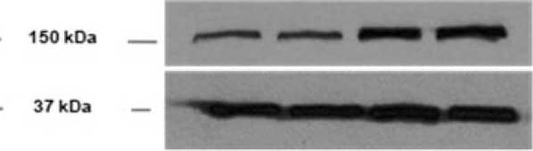  Lymphatic function assessment in mice following a specific knockdown of LDLR in murine endothelial cells. Two weeks after the intraperitoneal injection of an adeno-associated virus type 1 (AAV1) containing a shRNA targeting LDLR, skin draining lymph nodes were harvested, digested and analyzed by flow cytometry to assess lymphatic endothelial cell (LEC)-specific knockdown of LDLR expression in mice. Membrane-bound LDLR expression was measured on (A) CD45-CD31+Podoplanin+ and (B) CD45+ cells. Fluorescence minus one (FMO) control was used for LDLR expression, as depicted by the dotted line in the first histogram. White histogram, shSCR and dark histogram, shLldlr. LDLR expression was also determine by immunoblotting in (C) aorta isolated from female mice and (D) in liver from wild-type and Pcsk9-/- male (full dot) and female (empty dot) mice. ShSCR in black and ShLdlr in grey. Total plasmatic cholesterol was measured following FPLC in each liproprotein subfraction in (E) wild-type and (F)Pcsk9-/-female (dotted lines) and male (solid lines) mice treated with shSCR (black lines) and shLdlr (grey lines). Lymphatic contraction capacity was assessed by fluorescent in vivo imaging in (G) wild-type and (H)Pcsk9-/- mice. Black histogram, ShSCR and grey histogram, ShLdlr. n=3-9. Statistics **p < 0,01. Image collected and cropped by CiteAb from the following open publication (//pubmed.ncbi.nlm.nih.gov/35154499), licensed under a CC-BY license. Not internally tested by R&D Systems.