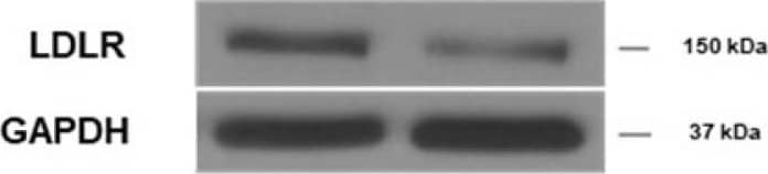  Lymphatic function assessment in mice following a specific knockdown of LDLR in murine endothelial cells. Two weeks after the intraperitoneal injection of an adeno-associated virus type 1 (AAV1) containing a shRNA targeting LDLR, skin draining lymph nodes were harvested, digested and analyzed by flow cytometry to assess lymphatic endothelial cell (LEC)-specific knockdown of LDLR expression in mice. Membrane-bound LDLR expression was measured on (A) CD45-CD31+Podoplanin+ and (B) CD45+ cells. Fluorescence minus one (FMO) control was used for LDLR expression, as depicted by the dotted line in the first histogram. White histogram, shSCR and dark histogram, shLldlr. LDLR expression was also determine by immunoblotting in (C) aorta isolated from female mice and (D) in liver from wild-type and Pcsk9-/- male (full dot) and female (empty dot) mice. ShSCR in black and ShLdlr in grey. Total plasmatic cholesterol was measured following FPLC in each liproprotein subfraction in (E) wild-type and (F)Pcsk9-/-female (dotted lines) and male (solid lines) mice treated with shSCR (black lines) and shLdlr (grey lines). Lymphatic contraction capacity was assessed by fluorescent in vivo imaging in (G) wild-type and (H)Pcsk9-/- mice. Black histogram, ShSCR and grey histogram, ShLdlr. n=3-9. Statistics **p < 0,01. Image collected and cropped by CiteAb from the following open publication (//pubmed.ncbi.nlm.nih.gov/35154499), licensed under a CC-BY license. Not internally tested by R&D Systems.