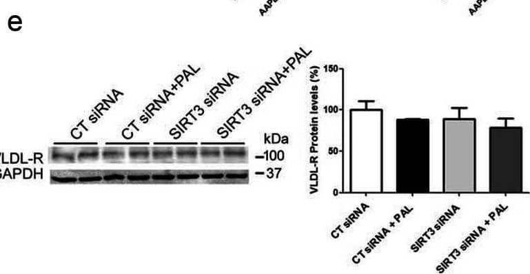 Western Blot VLDLR Antibody [Unconjugated]