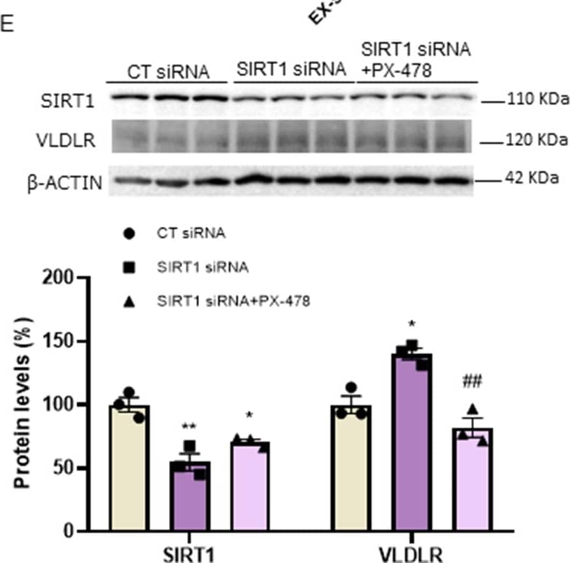 SIRT1 inhibition increases VLDLR levels and VLDL uptake in human Huh-7 cells. (A) mRNA and (B) immunoblot analysis of VLDLR in human Huh-7 cells in the absence (control, CT) or presence of 10 µM EX-527 for 24 h. Immunoblot analysis of (C) VLDLR and (D) VLDL uptake in human Huh-7 cells in the absence (control, CT) or presence of 10 µM EX-527, or in the presence of both 10 µM EX-527 and 20 µM PX-478 for 24 h. (E) Immunoblot analysis of SIRT1 and VLDLR in Huh-7 cells transfected with control siRNA or SIRT1 siRNA in the absence or presence of 20 µM PX-478. Data are presented as the mean ± SEM. Significant differences were established by Student’s t-test or one-way ANOVA with Tukey’s post-hoc test. *p < 0.05 and **p < 0.01 vs. CT. #p < 0.05, ##p < 0.01, and ###p < 0.001 vs. EX-527 or SIRT1 siRNA. n = 3 or 4 per group Image collected and cropped by CiteAb from the following open publication (//pubmed.ncbi.nlm.nih.gov/38807218), licensed under a CC-BY license. Not internally tested by R&D Systems.