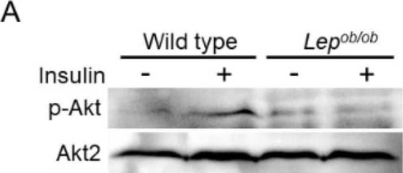 The activation of upstream regulators for Rac1 following insulin stimulation in the gastrocnemius muscle of Lepob/ob mice. (A) Insulin was administered by intravenous injection, and the phosphorylation of serine in the C-terminal hydrophobic motif of Akt proteins (serine-474 of Akt2) in gastrocnemius muscle was assessed by immunoblot analysis. Total Akt2 and phosphorylated Akt molecules were detected. (B) Quantification of the phosphorylation level of Akt (p-Akt/Akt2) relative to that in unstimulated wild-type muscle. Data are shown as means ± S.E. (n = 3). ** p < 0.01 (Student’s t-test). (C) Insulin was administered by intravenous injection, and the translocation of FLJ00068 to the plasma membrane in gastrocnemius muscle was assessed by immunoblot analysis. FLJ00068 molecules in cytosolic (C) and plasma membrane (P) fractions were detected. (D) Quantification of the protein expression level of FLJ00068 in the cytosol (FLJ00068/ alpha -tubulin) relative to that in unstimulated wild-type muscle. Data are shown as means ± S.E. (n = 3). (E) Quantification of the protein expression level of FLJ00068 in the plasma membrane (FLJ00068/Na+-K+-ATPase) relative to that in unstimulated wild-type muscle. Data are shown as means ± S.E. (n = 3). ** p < 0.01, *** p < 0.001, (Student’s t-test). Image collected and cropped by CiteAb from the following open publication (//pubmed.ncbi.nlm.nih.gov/37511290), licensed under a CC-BY license. Not internally tested by R&D Systems.