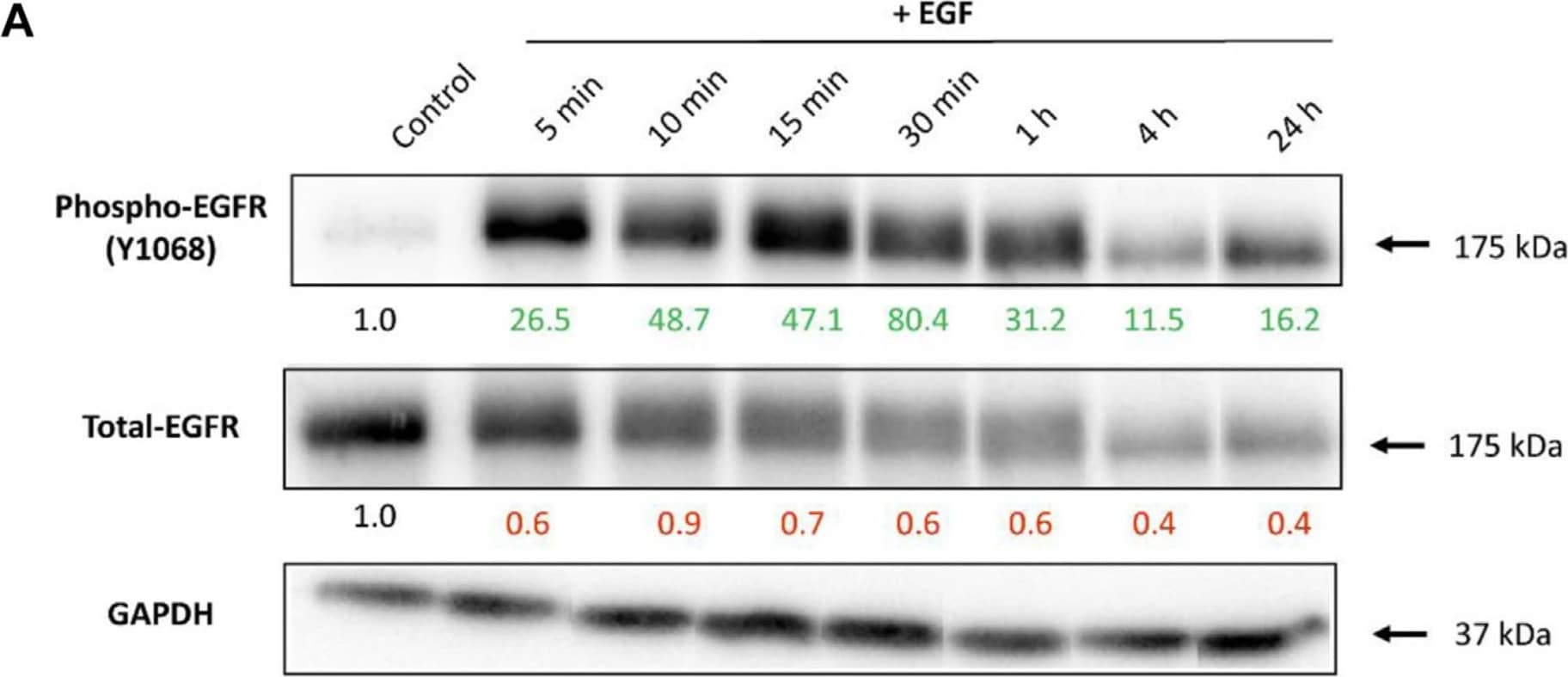 The EGFR expression upon cell stimulation with EGF.(A) Representative Western blot images showing expression of phosphorylated- and total-EGFR (Phospho-EGFR and Total-EGFR), upon EGF stimulation at different time points. GAPDH served as an internal control for protein loading. The average expression values of the indicated protein were determined via densitometry (Fiji software) from three independent experiments and presented as a fold change over the negative controls. Increased expression is marked in green and decreased in red. Full Western blot images including the corresponding controls for each time point and weight marker are shown in Supplementary Figure S2. (B) Localization of EGFR upon cell stimulation with EGF assessed via confocal microscopy. Receptor internalization was observed 5 min after A549 stimulation with EGF, followed by receptor recycling back to the membrane staring at 15 min. Magenta: EGFR;Cyan: nuclei. Scale bar: 10 μm. Image collected and cropped by CiteAb from the following open publication (//pubmed.ncbi.nlm.nih.gov/37954478), licensed under a CC-BY license. Not internally tested by R&D Systems.