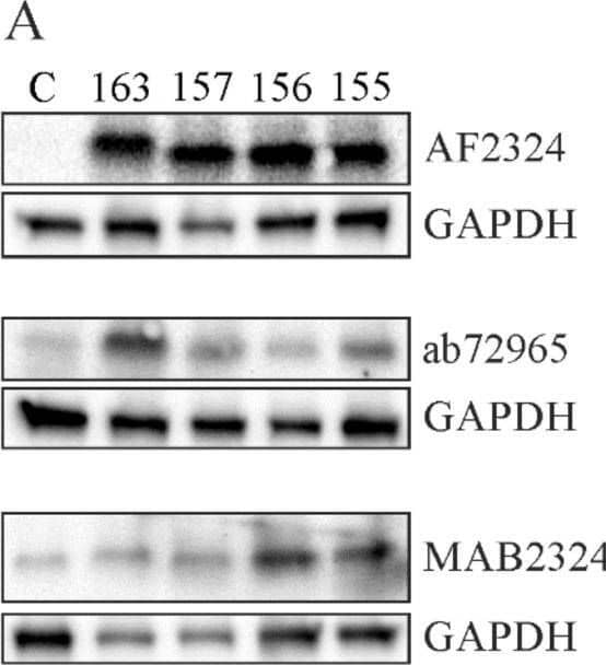 Analysis of chemerin variants by immunoblot. (A) Human chemerin isoforms 163, 157, 156 and 155 were overexpressed in HepG2 cells and protein was detected by three different antibodies (C, control-transfected cells). (B) Quantification of chemerin protein (n = 2). Image collected and cropped by CiteAb from the following open publication (//pubmed.ncbi.nlm.nih.gov/33066325), licensed under a CC-BY license. Not internally tested by R&D Systems.