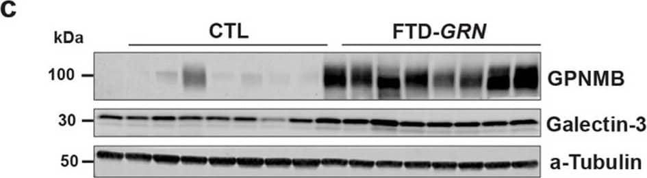 GPNMB and galectin-3 levels are elevated in FTD-GRN brains. a, b GPNMB and galectin-3 levels (ng/mg protein) were measured in frontal lobe tissue lysates generated from cognitively normal controls (CTL; n = 27) and FTD-GRN patients (n = 25). Data analyzed using unpaired t-test. c Representative immunoblots for GPNMB and galectin-3 in frontal lobe lysates from cognitively normal controls (n = 8) and FTD-GRN (n = 8) patients. d GPNMB levels (ng/mL) in CSF samples form cognitively normal controls (n = 14), FTD-GRN (n = 9), FTD-C9orf72 (n = 12) and FTD-MAPT (n = 12) samples quantified by ELISA. Data analyzed using one-way ANOVA. e, f GPNMB immunostaining was performed on frontal lobe tissue sections from cognitively normal controls (n = 5) (e) and FTD-GRN (n = 5) (f) patients. g, h Immunostaining for p-TDP 43 was stained on adjacent sections from identical samples in e, f as marker of FTLD pathology. i GPNMB staining intensity in human brain sections (e, f) were measured and presented as fold change. Representative immunofluorescence staining for cell markers (green) (j, n, r), GPNMB (red) (k, o, s), DAPI (blue) (i, p, t) in paraffin sections of brains from FTD-GRN cases. Iba-1, GFAP, NeuN used for markers of human microglia, astrocytes, and neurons respectively. GPNMB and Iba-1 signals overlap (arrow) (m) whereas, no overlapping signal was observed in co-staining with GFAP or NeuN (q, u). Scale bars were labeled in the images. Data analyzed by unpaired t-test. Scale bars (20 µm) labeled in images and quantitative data are shown as mean ± SEM, *p < 0.05; **p < 0.01; ***p < 0.001; ****p < 0.0001 Image collected and cropped by CiteAb from the following open publication (//pubmed.ncbi.nlm.nih.gov/33028409), licensed under a CC-BY license. Not internally tested by R&D Systems.