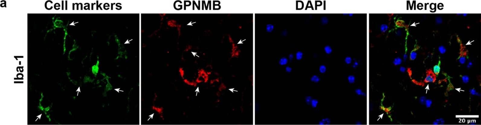 GPNMB and galectin-3 co-localize with Iba-1 positive microglia cells in Grn−/− mouse brain. a Representative immunofluorescent co-staining for different cell markers (Iba-1, microglia; GFAP, astrocytes; NeuN, neurons) are shown in green, GPNMB (red), and nuclei (DAPI; blue) in brains of 19-month-old Grn−/− mice. b Representative immunofluorescent co-staining for different cell markers (Iba-1, microglia; GFAP, astrocytes; NeuN, neurons) are shown in green, galectin-3 (red), and nuclei (DAPI; blue) in brains of 19-month-old Grn−/− mice. Scale bars (20 µm) labeled in images Image collected and cropped by CiteAb from the following open publication (//pubmed.ncbi.nlm.nih.gov/33028409), licensed under a CC-BY license. Not internally tested by R&D Systems.