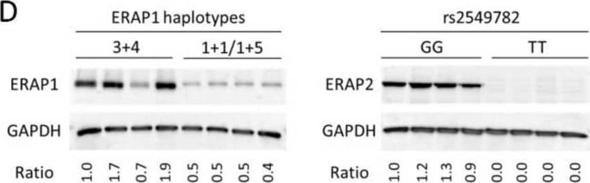 ERAP1 and ERAP2 expression quantitative trait loci. (A) Linkage disequilibrium (LD) plot of the selected SNPs in the ERAP1 and ERAP2 genes. The darkness of diamonds shows the strength of LD, darker colour means stronger LD, the number in the diamonds represent r2 between two SNPs. (B) eQTL analysis of rs27524 SNP in LCLs on ERAP1 (left) and on ERAP2 expression (right). Significance was calculated with one-way ANOVA with linear regression. (C) eQTL analysis of the ERAP1 haplotype. Significance was tested using Kruskal-Wallis test with Dunn’s multiple comparison post-test. (D) ERAP1 and ERAP2 protein (p)QTL effect in LCLs by western blot. (E) pQTL analysis of the ERAP1 haplotypes (left) and of ERAP2 SNP rs2549782 (right) in HL cell lines by western blot. The ratio indicates the relative ERAP1 or ERAP2 protein level normalized by the GAPDH protein level. (F) Representative images of immunohistochemical staining of ERAP1 and ERAP2 in HL tumor tissue sections of nodular sclerosis and mixed cellularity subtype. Arrows indicate Hodgkin Reed-Sternberg cells. Statistically significant changes are indicated by ** = p ≤ 0.01, and *** = p ≤ 0.001. Image collected and cropped by CiteAb from the following open publication (//pubmed.ncbi.nlm.nih.gov/33499248), licensed under a CC-BY license. Not internally tested by R&D Systems.