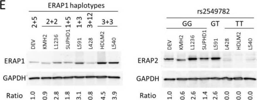ERAP1 and ERAP2 expression quantitative trait loci. (A) Linkage disequilibrium (LD) plot of the selected SNPs in the ERAP1 and ERAP2 genes. The darkness of diamonds shows the strength of LD, darker colour means stronger LD, the number in the diamonds represent r2 between two SNPs. (B) eQTL analysis of rs27524 SNP in LCLs on ERAP1 (left) and on ERAP2 expression (right). Significance was calculated with one-way ANOVA with linear regression. (C) eQTL analysis of the ERAP1 haplotype. Significance was tested using Kruskal-Wallis test with Dunn’s multiple comparison post-test. (D) ERAP1 and ERAP2 protein (p)QTL effect in LCLs by western blot. (E) pQTL analysis of the ERAP1 haplotypes (left) and of ERAP2 SNP rs2549782 (right) in HL cell lines by western blot. The ratio indicates the relative ERAP1 or ERAP2 protein level normalized by the GAPDH protein level. (F) Representative images of immunohistochemical staining of ERAP1 and ERAP2 in HL tumor tissue sections of nodular sclerosis and mixed cellularity subtype. Arrows indicate Hodgkin Reed-Sternberg cells. Statistically significant changes are indicated by ** = p ≤ 0.01, and *** = p ≤ 0.001. Image collected and cropped by CiteAb from the following open publication (//pubmed.ncbi.nlm.nih.gov/33499248), licensed under a CC-BY license. Not internally tested by R&D Systems.