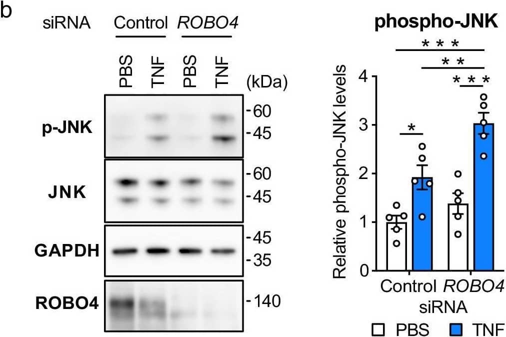 Western Blot ROBO4 Antibody [Unconjugated]