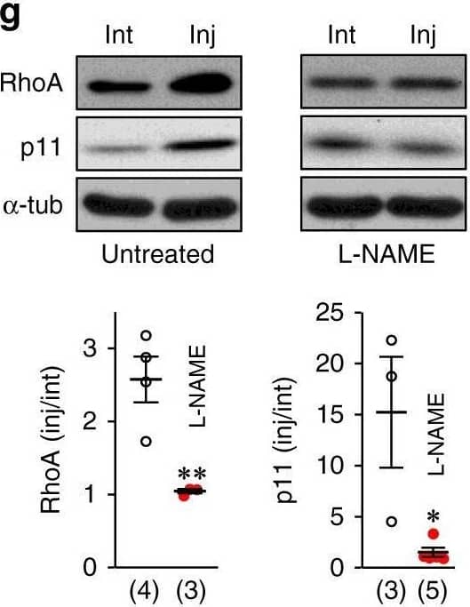 RNS upregulates p11 and inhibits TASK channels in a traumatic model of MN degeneration. g Immunoblots for RhoA and p11 of HNs from P7 rats treated as shown. gapdh and  alpha -tub were the internal controls for qRT-PCR and western blotting, respectively. Image collected and cropped by CiteAb from the following open publication (//pubmed.ncbi.nlm.nih.gov/31439839), licensed under a CC-BY license. Not internally tested by R&D Systems.