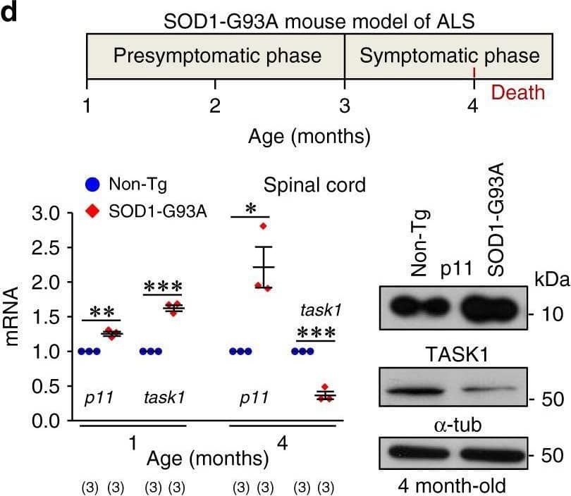 Neuroprotective effects of siRNAp11 in the SOD1-G93A mouse model of ALS. c. d mRNA (left) and protein (right) levels of p11 and TASK1 in the spinal cord of SOD1-G93A mice and their Non-Tg littermates, at the indicated stages (see schematic on top). Image collected and cropped by CiteAb from the following open publication (//pubmed.ncbi.nlm.nih.gov/31439839), licensed under a CC-BY license. Not internally tested by R&D Systems.