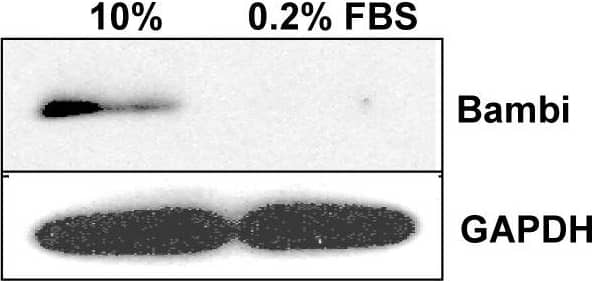 BAMBI protein levels in overexpressing HUVECs.7A. Representative Western blot and densitometry analysis for BAMBI in HUVECs overexpressing BAMBI (lentiviral system). Cells were cultured in 10% FBS or 0.2% FBS for 24 hours prior to protein extraction. GAPDH is shown as loading control. 7B. For densitometry analysis, normalized relative intensities were calculated from band intensity values obtained using the NIH Image J program. Data are means +/− SEM of relative BAMBI∶GAPDH ratios (normalized to 10% FBS control cells) for two independent experiments. Image collected and cropped by CiteAb from the following open publication (//pubmed.ncbi.nlm.nih.gov/20886049), licensed under a CC-BY license. Not internally tested by R&D Systems.