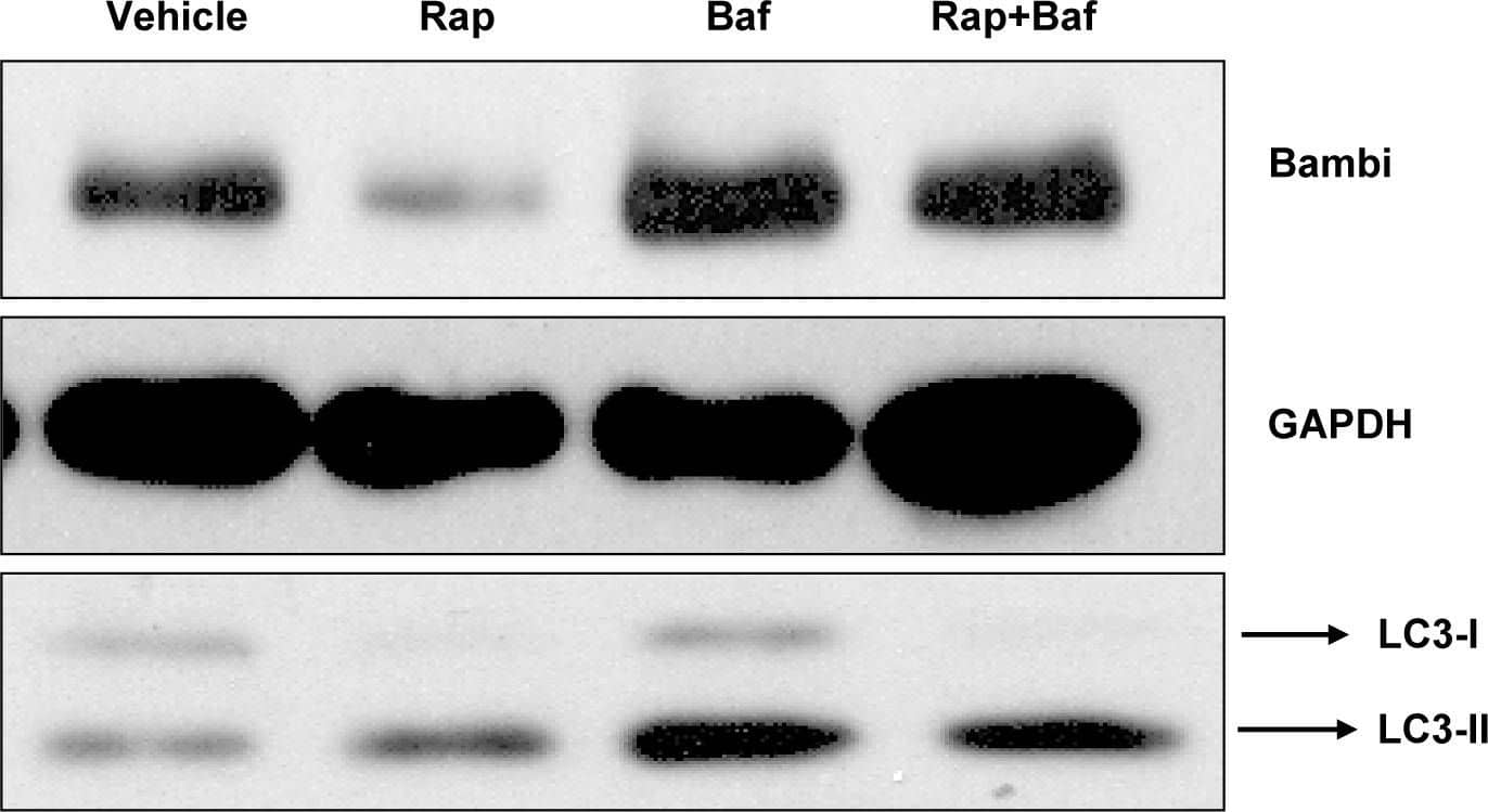 Rapamycin-induced autophagy in HUVEC.Western blot for BAMBI, GAPDH, and LC3 in BAMBI overexpressing HUVECs cultured in 10% FBS and treated with vehicle (CTRL), rapamycin, bafilomycin or bafilomycin plus rapamycin for 24 hours. Rapamycin alone reduces the BAMBI band, whereas bafilomycin alone and even in combination with rapamycin enhances it. Rapamycin causes a shift from the LC3-I to the LC3-II band, and bafilomycin alone enhances both LC3 bands. Bafilomycin does not, however, prevent the shift from LC3-I to LC3-II induced by rapamycin. Image collected and cropped by CiteAb from the following open publication (//pubmed.ncbi.nlm.nih.gov/20886049), licensed under a CC-BY license. Not internally tested by R&D Systems.