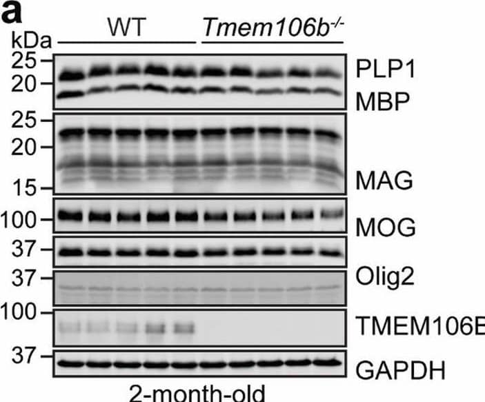 Myelination defects, axonal degeneration of Purkinje cells and disruption of cerebellar cortico-nuclear connection in young Tmem106b−/− mice. a, b Western blot analysis of myelin proteins and GAPDH in 2-month-old WT and Tmem106b−/− cerebellar lysates. Protein levels were quantified and normalized to GAPDH in b. n = 5, *, p < 0.05, **, p < 0.01, unpaired t-test. c–e Cerebellar sections from 5‐month‐old WT and Tmem106b−/− mice were co-stained with anti-calbindin, myelin basic protein (MBP), and NF-H antibodies. MBP intensity around Purkinje cell axon and the number of giant torpedos in the axon of Purkinje cells were quantified in d and e, respectively. Scale bar = 10 µm. n = 3–4, ***, p < 0.001, unpaired t-test. f Cerebellar sections from 5‐month‐old Tmem106b−/− mice were co-stained with anti-calbindin and Cath D antibodies. Scale bar = 10 µm. g, h Cerebellar sections from 2‐month‐old WT and Tmem106b−/− mice were immunostained with antibodies of calbindin, synaptophysin (SYN, presynaptic marker), and MAP2. The intensity of SYN around MAP2-positive soma in the DCN region was quantified in h. Scale bar = 10 µm. n = 3, ***, p < 0.001, non-parametric test (Mann Whitney test) Image collected and cropped by CiteAb from the following open publication (//pubmed.ncbi.nlm.nih.gov/35287730), licensed under a CC-BY license. Not internally tested by R&D Systems.