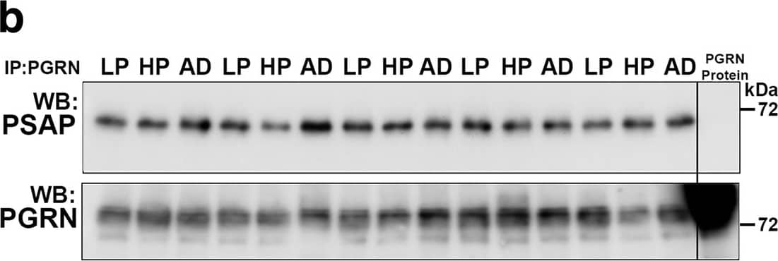 Biochemical analysis of interactions of progranulin and prosaposin in MTG brain samples. (a-b). Co-immunoprecipitation of Progranulin and Prosaposin. a). Western blot control analyses to show interactions of progranulin (PGRN) and prosaposin (PSAP). Immunoprecipitation of PGRN-overexpressing HEK (HEK and HEK1) cells and AD brain sample with protein G- (goat antibody) or protein A- (rabbit antibody) antibody-conjugated magnetic beads. Beads were prepared using non-immune goat IgG, goat anti-PGRN and rabbit anti-PSAP. Immunoprecipitated samples were separated by gel electrophoresis, transferred to membranes, and probed with antibodies to PSAP and PGRN. Samples of total protein (non-immunoprecipitated) from PGRN-overexpressing HEK (HEK) cells and brain sample (AD) were analyzed as specificity controls. Samples immunoprecipitated with PGRN antibody contained PSAP, and samples precipitated with PSAP antibody contained PGRN. b). All of the brain samples from LP, AD and HP cases precipitated with PGRN antibody pulled-down PSAP. A series of cases (n = 5) from each group were analyzed. Western blot images for both antibodies are shown. (c-f) Biochemical analysis of prosaposin in MTG brain protein extracts. c). Western blot analysis of total PSAP protein levels in MTG samples. Representative image of western blot demonstrating PSAP protein in samples from LP, HP and AD cases. The complete images of all samples analyzed for PSAP are shown as Additional file 4: Figure. S4B. D). Scatter plot showing expression levels of PSAP protein in the different groups. Results represent mean ±S.E.M. Significantly increased levels of PSAP protein were present in AD case compared to LP and HP cases but not between LP and HP cases. Significant increased levels of PSAP protein in MTG samples from AD compared to HP (* p < 0.05) and LP (** p < 0.01). e). Positive correlation between PSAP and PGRN protein levels in MTG samples (Pearson r = 0.4674, p = 0.0070). f). Positive correlation between PSAP and A beta  protein levels in MTG samples (Pearson r = 0.4584, p = 0.0083). Image collected and cropped by CiteAb from the following publication (//pubmed.ncbi.nlm.nih.gov/31864418), licensed under a CC-BY license. Not internally tested by R&D Systems.