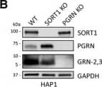 <b>Genetic Strategies Validation. </b>GRN levels are regulated by SORT1 and TMEM106B expression. A, HAP1 PGRN KO cells were treated with C-TAP PGRN or N-TAP PGRN (5 µg/ml) for 24 h and lysates were analyzed for PGRN and GRN-2,3 by immunoblot. B, HAP1 WT, SORT1 KO, and PGRN KO cell lysates were analyzed for endogenous levels of SORT1, PGRN, and GRN-2,3 by immunoblot. C, D, Quantification of (C) PGRN and (D) GRN-2,3 from the experiment in B. E, Overexpression of TMEM106B in HeLa cells for 48-h results in the formation of large vacuoles. Scale bar, 20 µm. F, HeLa cells were transfected with empty vector or TMEM106B for 48 h and lysates were analyzed for PGRN and GRN-2,3 by immunoblot. G-I, Quantification of (G) intracellular PGRN, (H) intracellular GRN-2,3, and (I) secreted PGRN (by ELISA) from the experiment in F. Arrow in F denotes endogenous, intermediate PGRN cleavage product. J, Overexpression of TMEM106B for 24 h in HAP1 PGRN KO cells results in the formation of large vacuoles. Scale bar, 10 µm. K, HAP1 PGRN KO cells were transfected with TMEM106B for 24 h and then treated with mCherry-PGRN (5 µg/ml) for an additional 24 h. Lysates were analyzed for PGRN and GRN-2,3 by immunoblot. L, M, Quantification of (L) PGRN and (M) GRN-2,3 from the experiment in K. For all immunoblots, PGRN and GRN-2,3 were detected with R&D AF2420 and Sigma antibodies, respectively. All immunoblot images are representative of at least three independent experiments and quantitative data are presented as mean ± SEM of three independent experiments; *differs from control p < 0.05; **p < 0.01; ***p < 0.001; ns = not significant. Image collected and cropped by CiteAb from the following publication (//pubmed.ncbi.nlm.nih.gov/28828399), licensed under a CC-BY license. Not internally tested by R&D Systems.