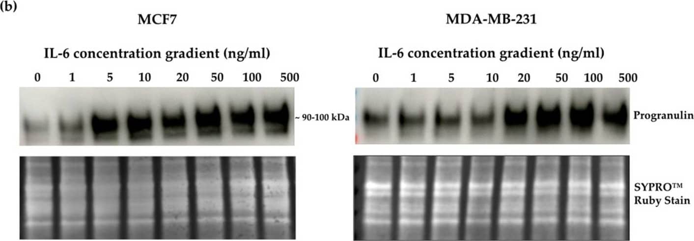 Crosslink between progranulin and IL-6 expression in breast cancer cell lines. Immunoblotting of IL-6, IL-8 and progranulin protein expression in MCF7 and MDA-MB-231 breast cancer cell lines. (a) Cells treated with increasing concentrations of progranulin showed an increase in IL-6 and IL-8 expression for 48 h. Treatment with an IL-6 (b) or IL-8 (c) concentration gradient led to an increased progranulin expression in MCF7 and MDA-MB-231 cells. SYPRO™ Ruby (Bio-Rad) stain was used as a loading control. Representative images from one of three independent experiments are shown. Western blot data are cut for visualization purposes, and all samples for the respective antibody were analyzed on the same blot. PGRN: progranulin, IL: interleukin. The uncropped bolts are shown in Supplementary Materials. Image collected and cropped by CiteAb from the following open publication (//www.mdpi.com/2072-6694/15/24/5757), licensed under a CC-BY license. Not internally tested by R&D Systems.