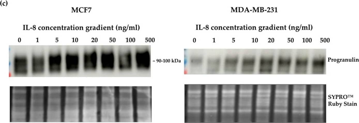 Crosslink between progranulin and IL-6 expression in breast cancer cell lines. Immunoblotting of IL-6, IL-8 and progranulin protein expression in MCF7 and MDA-MB-231 breast cancer cell lines. (a) Cells treated with increasing concentrations of progranulin showed an increase in IL-6 and IL-8 expression for 48 h. Treatment with an IL-6 (b) or IL-8 (c) concentration gradient led to an increased progranulin expression in MCF7 and MDA-MB-231 cells. SYPRO™ Ruby (Bio-Rad) stain was used as a loading control. Representative images from one of three independent experiments are shown. Western blot data are cut for visualization purposes, and all samples for the respective antibody were analyzed on the same blot. PGRN: progranulin, IL: interleukin. The uncropped bolts are shown in Supplementary Materials. Image collected and cropped by CiteAb from the following open publication (//www.mdpi.com/2072-6694/15/24/5757), licensed under a CC-BY license. Not internally tested by R&D Systems.