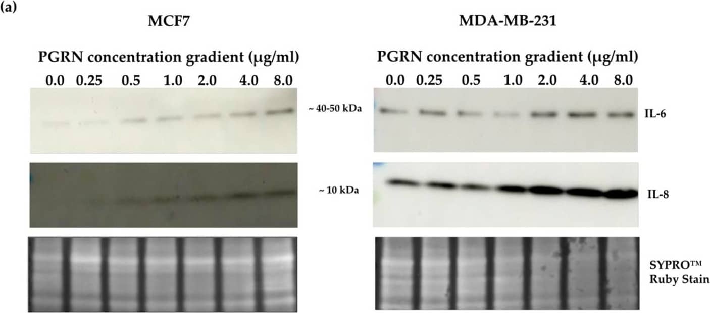 Crosslink between progranulin and IL-6 expression in breast cancer cell lines. Immunoblotting of IL-6, IL-8 and progranulin protein expression in MCF7 and MDA-MB-231 breast cancer cell lines. (a) Cells treated with increasing concentrations of progranulin showed an increase in IL-6 and IL-8 expression for 48 h. Treatment with an IL-6 (b) or IL-8 (c) concentration gradient led to an increased progranulin expression in MCF7 and MDA-MB-231 cells. SYPRO™ Ruby (Bio-Rad) stain was used as a loading control. Representative images from one of three independent experiments are shown. Western blot data are cut for visualization purposes, and all samples for the respective antibody were analyzed on the same blot. PGRN: progranulin, IL: interleukin. The uncropped bolts are shown in Supplementary Materials. Image collected and cropped by CiteAb from the following open publication (//www.mdpi.com/2072-6694/15/24/5757), licensed under a CC-BY license. Not internally tested by R&D Systems.