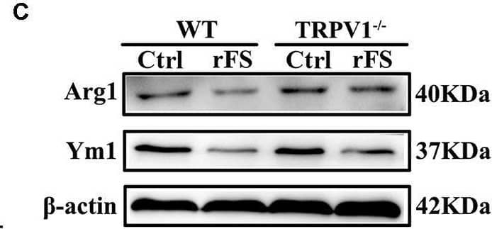 Western Blot YM1/Chitinase 3-like 3 Antibody [Unconjugated]
