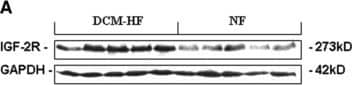 Western blot analysis of cardiac IGF-2R. (A) Representative Western blot analysis of cardiac IGF-2R expression. (B) Densitometric quantification of cardiac IGF-2R expression. The IGF-2R protein levels related to the internal standard protein GAPDH were calculated as the relative abundance. Densitometric analyses of the blots showed an apparent increase in IGF-2R in DCM failing hearts (DCM-HF, n = 5) compared with non-failing control hearts (NF, n = 5; **P < 0.01). Data are presented as mean ± S.D. Image collected and cropped by CiteAb from the following open publication (//pubmed.ncbi.nlm.nih.gov/21895964), licensed under a CC-BY license. Not internally tested by R&D Systems.