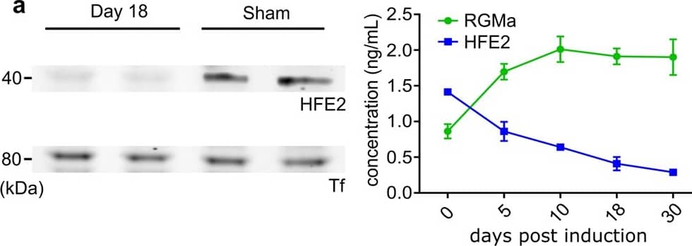 Western Blot RGM-A Antibody [Unconjugated]