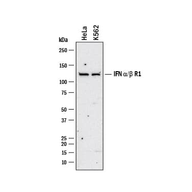 Western Blot IFN-alpha/beta R1 Antibody [Unconjugated]
