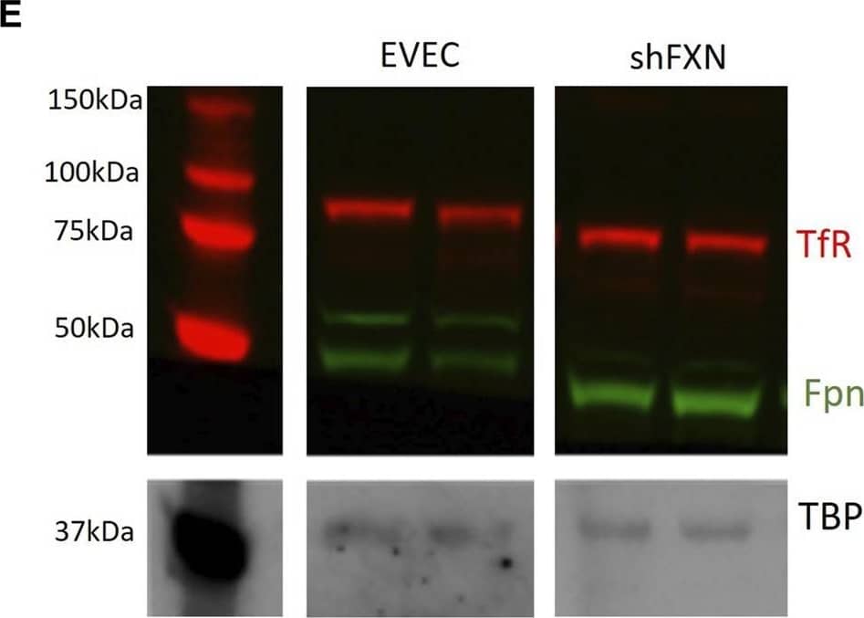 Western Blot TfR (Transferrin R) Antibody [Unconjugated]