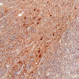 Spinesin was detected in immersion fixed paraffin-embedded sections of human brain using Goat Anti-Human Spinesin Antigen Affinity-purified Polyclonal Antibody (Catalog # AF2495) at 1.5 &micro;g/mL overnight at 4 &deg;C. Tissue was stained using the Anti-Goat IgG VisUCyte&trade; HRP Polymer Antibody (red; Catalog # VC004) and counterstained with hematoxylin (blue). Specific staining was localized to neurons. View our protocol for Fluorescent ICC Staining of Non-adherent Cells.
