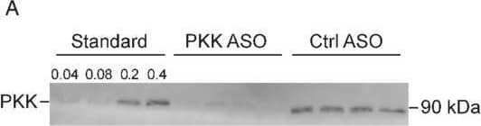 Western Blot Plasma Kallikrein/KLKB1 Antibody [Unconjugated]