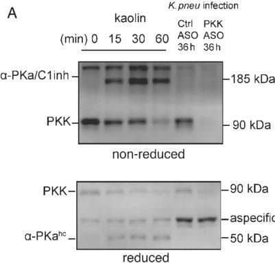 Western Blot Plasma Kallikrein/KLKB1 Antibody [Unconjugated]