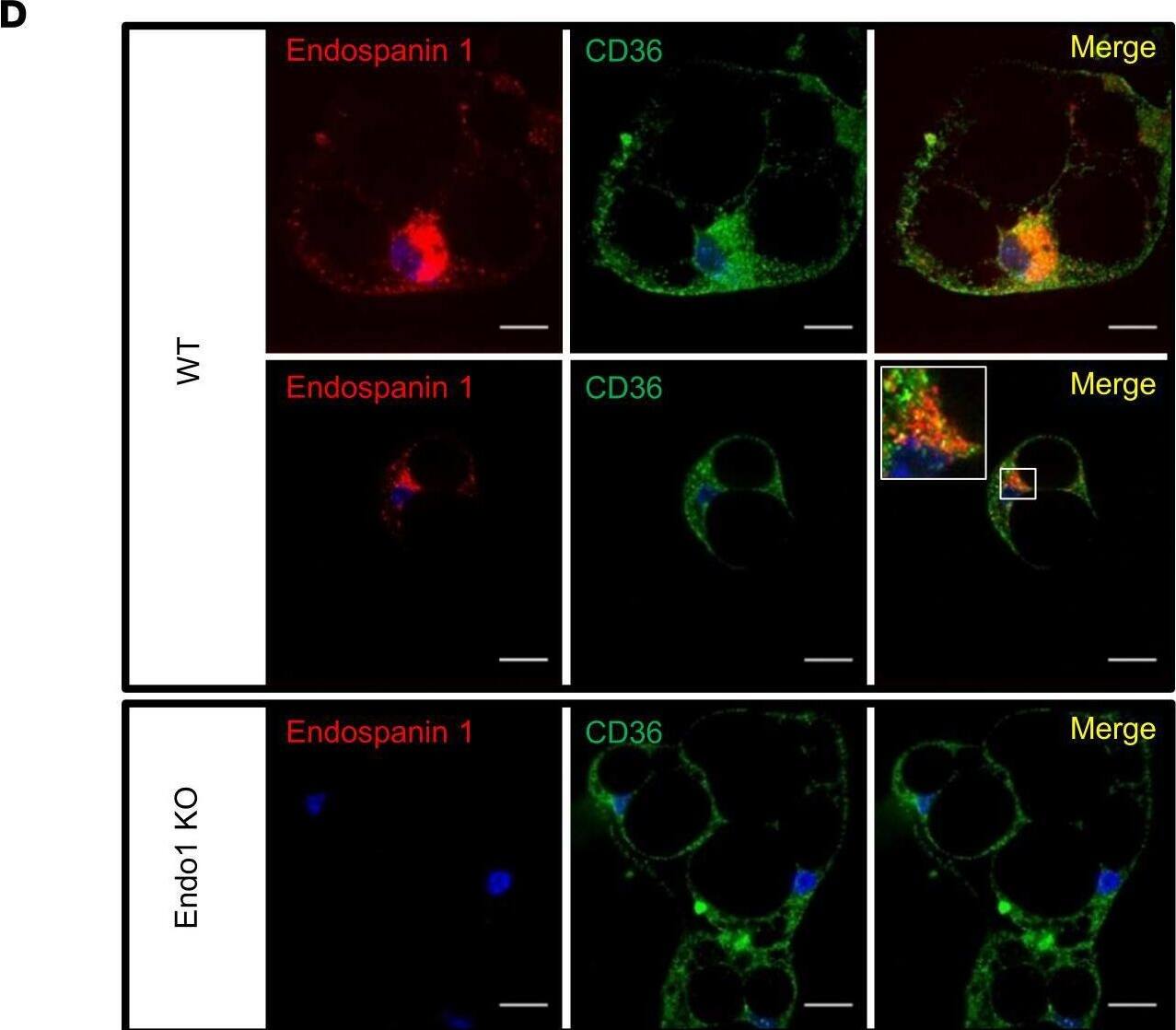 Endospanin 1 directly interacts with CD36.(A) Detection of Flag-CD36 in 6Myc-Endo1 immunoprecipitate from HEK293T cells coexpressing 6Myc-Endo1 and Flag-CD36 compared with HEK293T cells transfected with Flag-CD36 alone. Representative blots of 3 independent experiments. (B) Detection of 6Myc-Endo1 after Flag-CD36 immunoprecipitation from HEK293T cells coexpressing 6Myc-Endo1 and Flag-CD36 compared with HEK293T cells transfected with 6Myc-Endo1 alone. Representative blots of 3 independent experiments. (C) Kinetics of Endo1 and CD36 protein expression in differentiated adipocytes during differentiation of adipocyte precursors isolated from the stromal vascular fraction of the s.c. adipose tissue of WT mice into mature white adipocytes. Results are expressed as mean ± SEM of 8 independent experiments. One representative Western blot is shown. (D) Confocal immunofluorescence detection and colocalization of Endo1 (rabbit anti-Endo1) and CD36 (goat anti-CD36) in differentiated adipocytes. Nuclei (blue) are stained with fluorescent DAPI dye. Scale bar: 20 μm. Representative images of 4 independent experiments. (E) Detection of endogenous Endo1 and CD36 after immunoprecipitation with Endo1 or CD36 antibodies from lysates of visceral adipose tissue (VAT), gonadal adipose tissue (GAT), and s.c. adipose tissue (SAT) of WT and KO mice. Endo1-KO adipocytes and tissues were used as negative controls. The molecular weights of protein markers are indicated (kDa). Representative blots of 2 independent experiments. Image collected and cropped by CiteAb from the following open publication (//insight.jci.org/articles/view/168418), licensed under a CC-BY license. Not internally tested by R&D Systems.