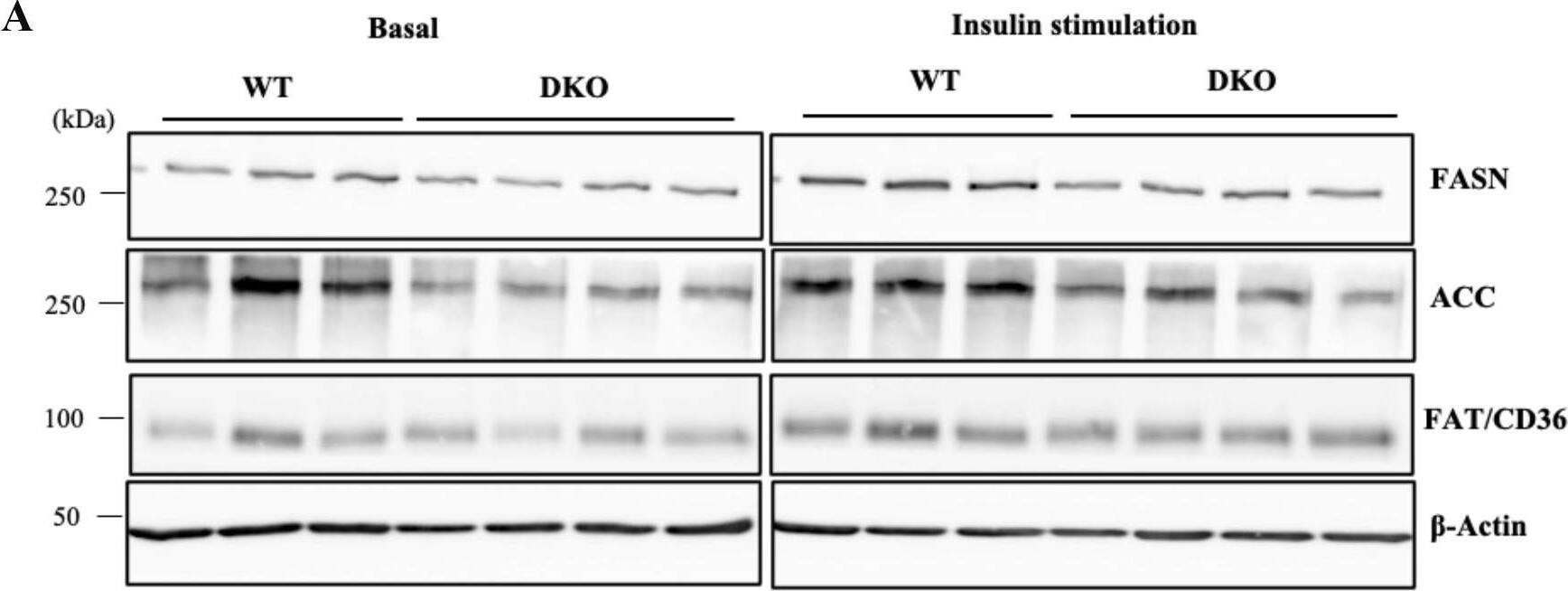 Induced levels of lipogenic proteins after insulin stimulation were lower in DKO hepatocytes.(A) Expression levels of FASN, ACC, and FAT/CD36 in hepatocytes at 360 min after insulin stimulation were analyzed by immunoblotting. (B) Expression levels of lipogenic molecules are presented by measuring band intensities after correction with those of  beta -Actin. Open and closed bars indicate WT and DKO hepatocytes, respectively. The numbers of mice examined were WT, n = 3; DKO, n = 4. Data are expressed as means ± S.D. *P<0.05, **P<0.01 and ***P<0.001 as compared between WT and DKO hepatocytes. #P<0.05 and ##P<0.01 as compared between basal and insulin stimulation. Image collected and cropped by CiteAb from the following open publication (//pubmed.ncbi.nlm.nih.gov/36827398), licensed under a CC-BY license. Not internally tested by R&D Systems.