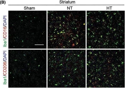 Hypothermia promotes a shift of microglia/macrophages towards an anti‐inflammatory phenotype in aged female mice 7 days after ischemic stroke. Mice were subjected to distal MCAO (dMCAO) or sham surgery. Normothermia (NT) or hypothermia (HT) was induced for 50 min immediately after dMCAO. Coronal brain sections were stained for Iba‐1 (a microglial/macrophage marker) and CD206 (an anti‐inflammatory marker) or CD16 (a pro‐inflammatory marker). (A) Representative images of Iba1/CD16 and Iba1/CD206 immunofluorescence staining in the ipsilateral peri‐infarct cortex (CTX) regions. (B) Representative images showing Iba1/CD16 and Iba1/CD206 immunofluorescence staining in the ipsilateral peri‐infarct striatum (STR) regions. (C) Representative magnified 3‐dimensional images of Iba1/CD16 and Iba1/CD206 staining. (D) Quantification of the total number of Iba1+ cells (upper panel), Iba1+/CD16+ cells (middle panel), and Iba1+/CD206+ cells (lower panel). The number of double‐positive cells was expressed as the number over 100 Iba1+ cells. n = 5 for sham (S), n = 6 for NT and n = 6 for HT. (E) Pearson correlation analysis of NeuN+ cells with Iba1+/CD206+ cells in the CTX region, n = 6 per group. (F) Pearson correlation analysis of  beta ‐APP+ cells with Iba1+/CD206+ cells in the CTX region, n = 6 per group. Scale bar: 50 μm. Data are shown as mean ± SD. *p < 0.05, **p < 0.01 NT vs. HT, ns, no significance. Image collected and cropped by CiteAb from the following open publication (//pubmed.ncbi.nlm.nih.gov/36341958), licensed under a CC-BY license. Not internally tested by R&D Systems.