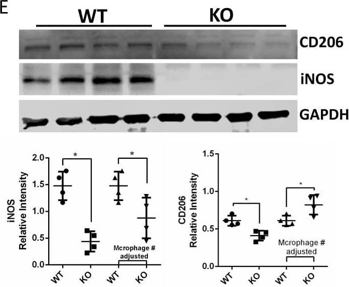 HCK knockout reduced kidney fibrosis in uIRIx model with regulation of macrophage activation.A Schematic diagram of strategy of uIRIx models. B Urine ACR and serum BUN for WT and HCK KO uIRIx mice. C Representative images of H&E, COL1A1 IF and Masson trichrome staining from WT and KO uIRIx kidneys. Morphometric quantification (n = 5 animals; 5 random fields/animal) of the COL1A1 (top) and Masson (lower) positive area. D Representative IF staining images and quantification of from kidneys of HCK and F4/80 macrophage from WT and HCK KO uIRIx kidneys. E Western blot and quantification of M1 and M2 macrophage markers from WT and HCK KO mice kidneys at 28 days post uIRIx. F Representative IF staining images and quantification of LC3 in macrophages from WT & HCK KO uIRIx kidneys. B, C and E*p < 0.05 with t test. Source data are provided as a Source Data file. Image collected and cropped by CiteAb from the following open publication (//pubmed.ncbi.nlm.nih.gov/37463911), licensed under a CC-BY license. Not internally tested by R&D Systems.