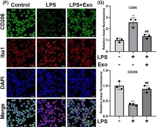 Immunocytochemistry/ Immunofluorescence MMR/CD206/Mannose Receptor Antibody [Unconjugated]