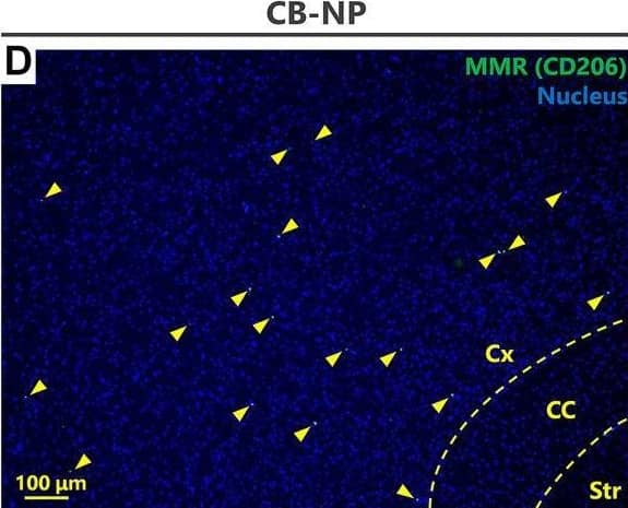 Immunohistochemistry MMR/CD206/Mannose Receptor Antibody [Unconjugated]
