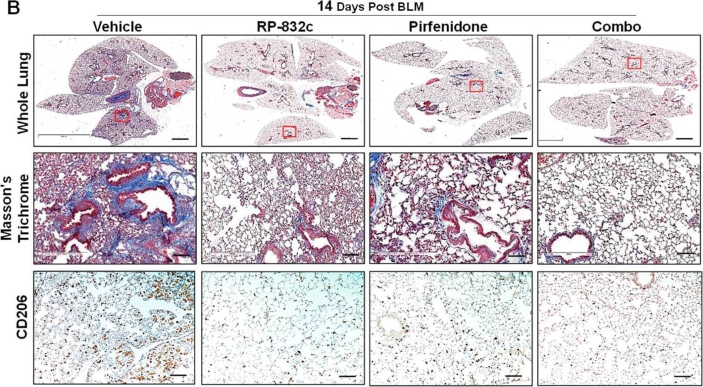 Immunohistochemistry MMR/CD206/Mannose Receptor Antibody [Unconjugated]