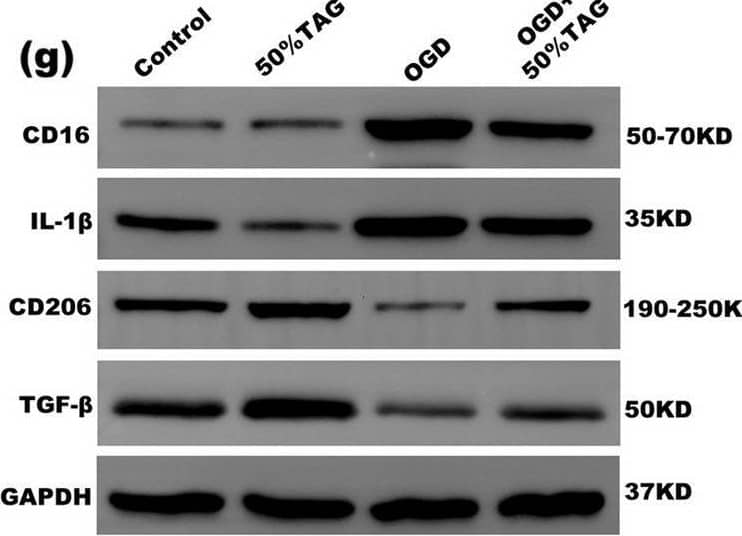 Western Blot MMR/CD206/Mannose Receptor Antibody [Unconjugated]