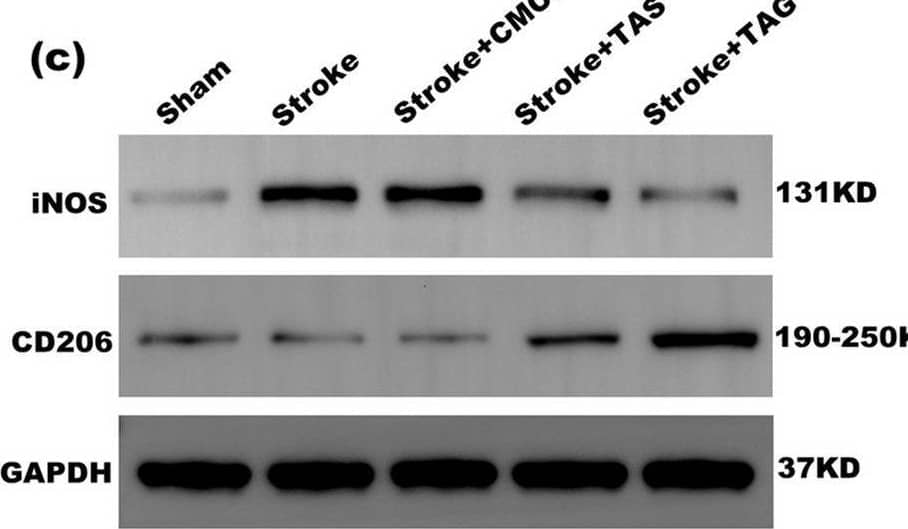 Western Blot MMR/CD206/Mannose Receptor Antibody [Unconjugated]