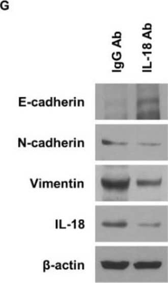 Western Blot IL-18/IL-1F4 Antibody [Unconjugated]