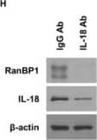 Western Blot IL-18/IL-1F4 Antibody [Unconjugated]