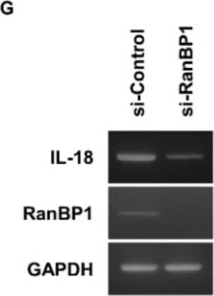 Western Blot IL-18/IL-1F4 Antibody [Unconjugated]