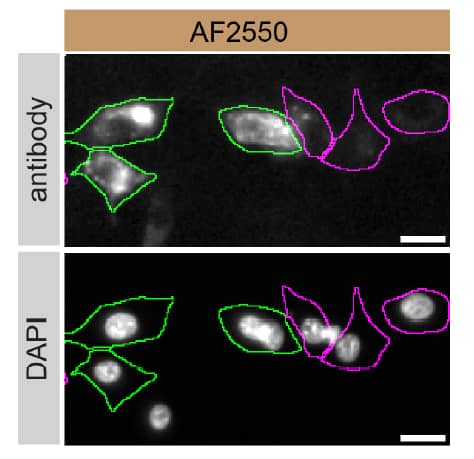 <b>Genetic Strategies Validation. </b>U‑87 MG human glioblastoma/astrocytoma parental cell line ctrl and Osteoactivin/GPNMB U-87 MG KD cells were labelled with a green or a far-red fluorescent dye, respectively. Cells were stained with Goat Anti-Human Osteoactivin/GPNMB Antigen Affinity-purified Polyclonal Antibody (Catalog # AF2550) followed by incubation with an Alexa-fluor 555 conjugated secondary antibody (upper panel). DAPI-only counterstained cells shown on a lower panel. Acquisition of the blue (nucleus-DAPI), green (identification of ctrl cells), red (antibody staining) and far-red (identification of KD cells) channels was performed. Representative images of the blue and red (grayscale) channels are shown. Ctrl and KD cells are outlined with green and magenta dashed line, respectively. Primary antibody concentration used: 0.2 µg/mL. Image, protocol and testing courtesy of YCharOS Inc. (ycharos.com).