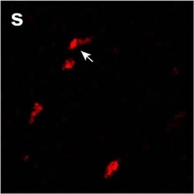 GPNMB and galectin-3 levels are elevated in FTD-GRN brains. a, b GPNMB and galectin-3 levels (ng/mg protein) were measured in frontal lobe tissue lysates generated from cognitively normal controls (CTL; n = 27) and FTD-GRN patients (n = 25). Data analyzed using unpaired t-test. c Representative immunoblots for GPNMB and galectin-3 in frontal lobe lysates from cognitively normal controls (n = 8) and FTD-GRN (n = 8) patients. d GPNMB levels (ng/mL) in CSF samples form cognitively normal controls (n = 14), FTD-GRN (n = 9), FTD-C9orf72 (n = 12) and FTD-MAPT (n = 12) samples quantified by ELISA. Data analyzed using one-way ANOVA. e, f GPNMB immunostaining was performed on frontal lobe tissue sections from cognitively normal controls (n = 5) (e) and FTD-GRN (n = 5) (f) patients. g, h Immunostaining for p-TDP 43 was stained on adjacent sections from identical samples in e, f as marker of FTLD pathology. i GPNMB staining intensity in human brain sections (e, f) were measured and presented as fold change. Representative immunofluorescence staining for cell markers (green) (j, n, r), GPNMB (red) (k, o, s), DAPI (blue) (i, p, t) in paraffin sections of brains from FTD-GRN cases. Iba-1, GFAP, NeuN used for markers of human microglia, astrocytes, and neurons respectively. GPNMB and Iba-1 signals overlap (arrow) (m) whereas, no overlapping signal was observed in co-staining with GFAP or NeuN (q, u). Scale bars were labeled in the images. Data analyzed by unpaired t-test. Scale bars (20 µm) labeled in images and quantitative data are shown as mean ± SEM, *p < 0.05; **p < 0.01; ***p < 0.001; ****p < 0.0001 Image collected and cropped by CiteAb from the following open publication (//pubmed.ncbi.nlm.nih.gov/33028409), licensed under a CC-BY license. Not internally tested by R&D Systems.