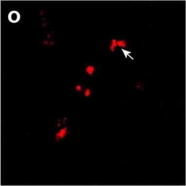 GPNMB and galectin-3 levels are elevated in FTD-GRN brains. a, b GPNMB and galectin-3 levels (ng/mg protein) were measured in frontal lobe tissue lysates generated from cognitively normal controls (CTL; n = 27) and FTD-GRN patients (n = 25). Data analyzed using unpaired t-test. c Representative immunoblots for GPNMB and galectin-3 in frontal lobe lysates from cognitively normal controls (n = 8) and FTD-GRN (n = 8) patients. d GPNMB levels (ng/mL) in CSF samples form cognitively normal controls (n = 14), FTD-GRN (n = 9), FTD-C9orf72 (n = 12) and FTD-MAPT (n = 12) samples quantified by ELISA. Data analyzed using one-way ANOVA. e, f GPNMB immunostaining was performed on frontal lobe tissue sections from cognitively normal controls (n = 5) (e) and FTD-GRN (n = 5) (f) patients. g, h Immunostaining for p-TDP 43 was stained on adjacent sections from identical samples in e, f as marker of FTLD pathology. i GPNMB staining intensity in human brain sections (e, f) were measured and presented as fold change. Representative immunofluorescence staining for cell markers (green) (j, n, r), GPNMB (red) (k, o, s), DAPI (blue) (i, p, t) in paraffin sections of brains from FTD-GRN cases. Iba-1, GFAP, NeuN used for markers of human microglia, astrocytes, and neurons respectively. GPNMB and Iba-1 signals overlap (arrow) (m) whereas, no overlapping signal was observed in co-staining with GFAP or NeuN (q, u). Scale bars were labeled in the images. Data analyzed by unpaired t-test. Scale bars (20 µm) labeled in images and quantitative data are shown as mean ± SEM, *p < 0.05; **p < 0.01; ***p < 0.001; ****p < 0.0001 Image collected and cropped by CiteAb from the following open publication (//pubmed.ncbi.nlm.nih.gov/33028409), licensed under a CC-BY license. Not internally tested by R&D Systems.