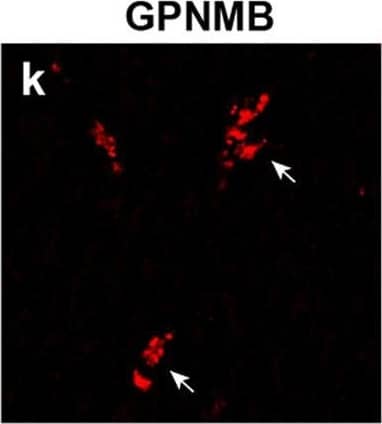 GPNMB and galectin-3 levels are elevated in FTD-GRN brains. a, b GPNMB and galectin-3 levels (ng/mg protein) were measured in frontal lobe tissue lysates generated from cognitively normal controls (CTL; n = 27) and FTD-GRN patients (n = 25). Data analyzed using unpaired t-test. c Representative immunoblots for GPNMB and galectin-3 in frontal lobe lysates from cognitively normal controls (n = 8) and FTD-GRN (n = 8) patients. d GPNMB levels (ng/mL) in CSF samples form cognitively normal controls (n = 14), FTD-GRN (n = 9), FTD-C9orf72 (n = 12) and FTD-MAPT (n = 12) samples quantified by ELISA. Data analyzed using one-way ANOVA. e, f GPNMB immunostaining was performed on frontal lobe tissue sections from cognitively normal controls (n = 5) (e) and FTD-GRN (n = 5) (f) patients. g, h Immunostaining for p-TDP 43 was stained on adjacent sections from identical samples in e, f as marker of FTLD pathology. i GPNMB staining intensity in human brain sections (e, f) were measured and presented as fold change. Representative immunofluorescence staining for cell markers (green) (j, n, r), GPNMB (red) (k, o, s), DAPI (blue) (i, p, t) in paraffin sections of brains from FTD-GRN cases. Iba-1, GFAP, NeuN used for markers of human microglia, astrocytes, and neurons respectively. GPNMB and Iba-1 signals overlap (arrow) (m) whereas, no overlapping signal was observed in co-staining with GFAP or NeuN (q, u). Scale bars were labeled in the images. Data analyzed by unpaired t-test. Scale bars (20 µm) labeled in images and quantitative data are shown as mean ± SEM, *p < 0.05; **p < 0.01; ***p < 0.001; ****p < 0.0001 Image collected and cropped by CiteAb from the following open publication (//pubmed.ncbi.nlm.nih.gov/33028409), licensed under a CC-BY license. Not internally tested by R&D Systems.