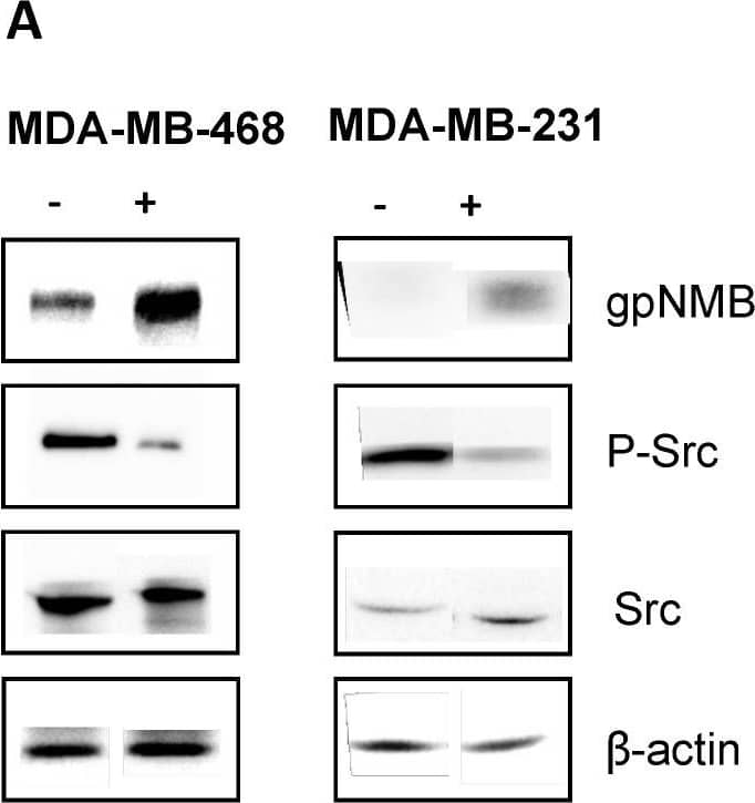 Dasatinib can upregulate the expression of gpNMB on MDA-MB-468 and MDA-MB-231 cells in vitro. (A) Western blot for gpNMB, ꞵ-actin, and dasatinib-related proteins p-Src, Src; (B) Normalized gpNMB expression relative to ꞵ-actin. DAS = dasatinib. Image collected and cropped by CiteAb from the following open publication (//pubmed.ncbi.nlm.nih.gov/36900378), licensed under a CC-BY license. Not internally tested by R&D Systems.
